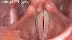 电声门/喉频谱
