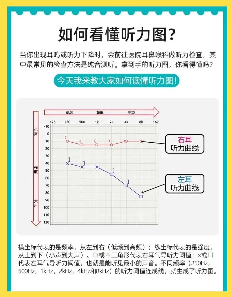 听力图解读