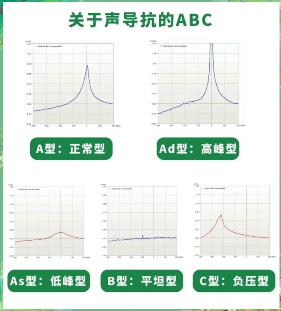 小儿和成人声导抗图形差异