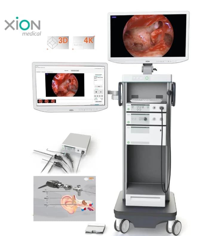 德国XION 4K耳内镜摄像系统